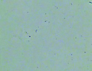 CPWによるイリゲーション後の状態