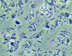 CPWによるイリゲーション前の状態