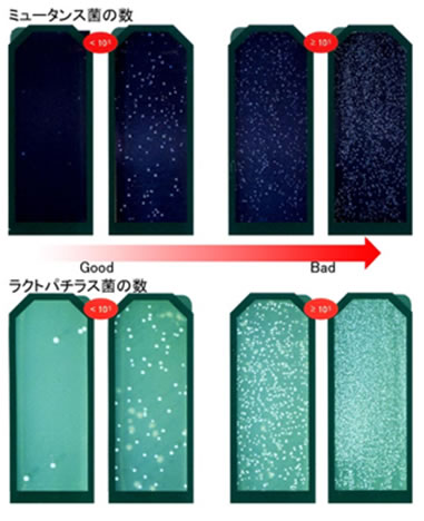 虫歯菌唾液検査（サリバテスト）