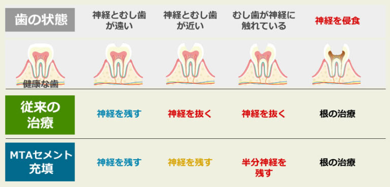 歯の状態を表した図